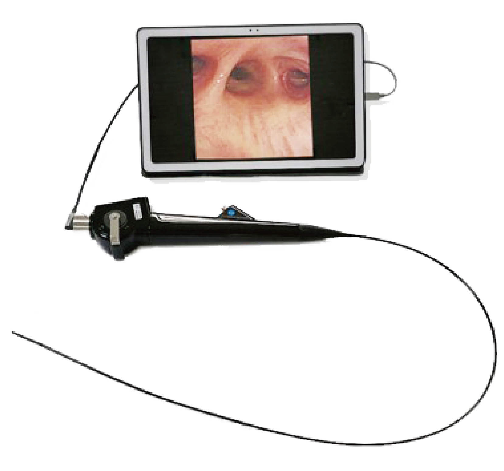 Mobile Endo